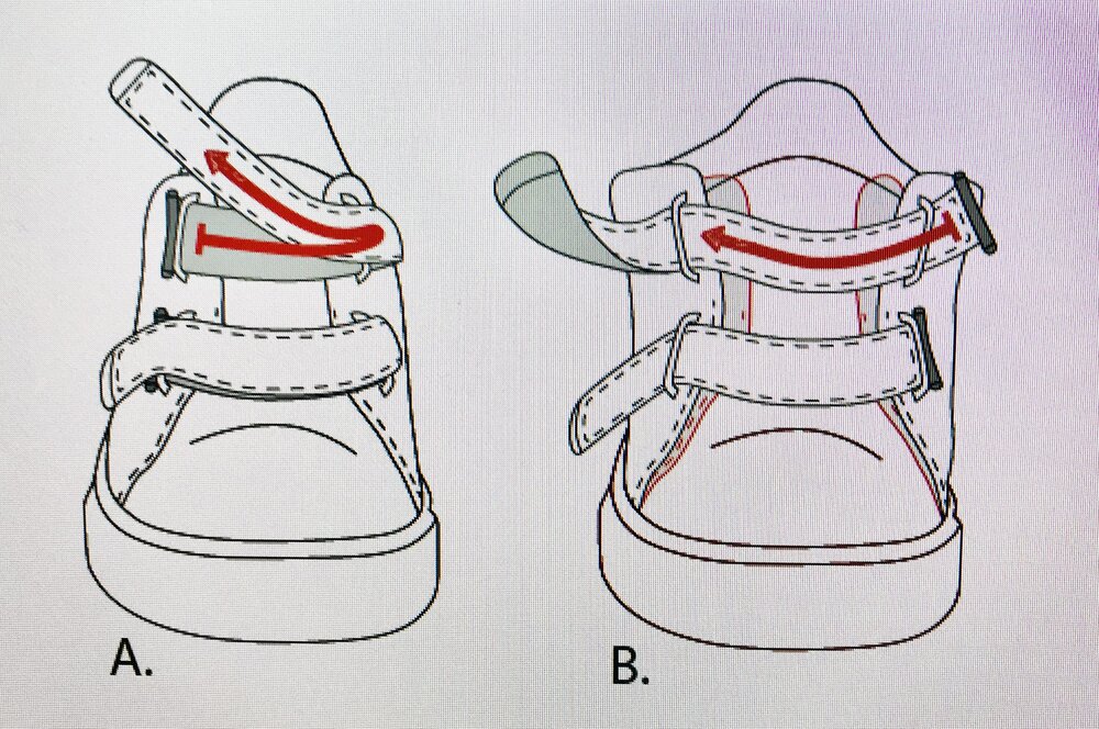 My Generation Ortheseschoen Laag Model (b) LAGAN